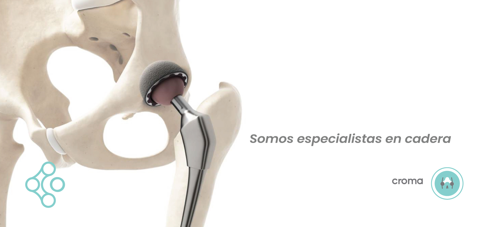 Somos Especialistas en cadera